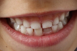 Nel microbioma il segreto di un sorriso sano (fonte: PickPik)